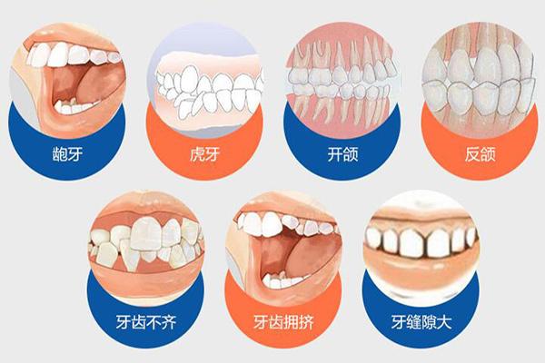 南京合肥隐形牙齿矫正费用贵不贵？要多少钱？