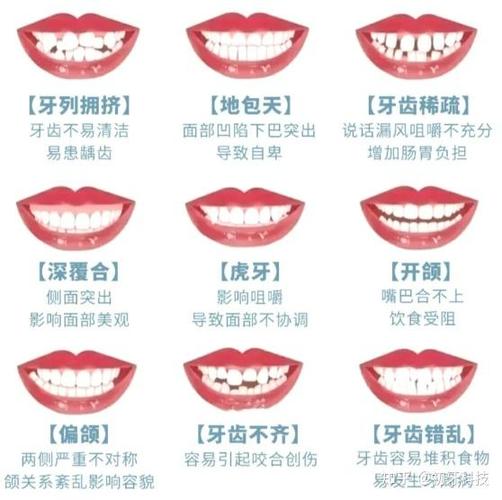 南京牙齿矫正价格多少？2024年整牙费用全解析