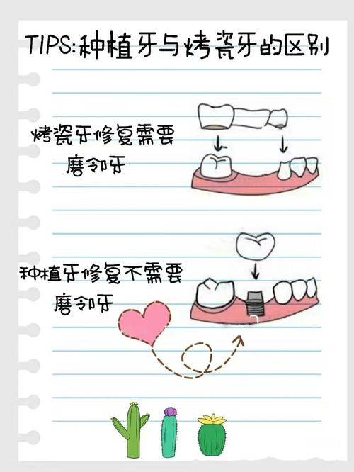 南京假牙和种植牙有什么区别 牙医告诉你哪种更划算