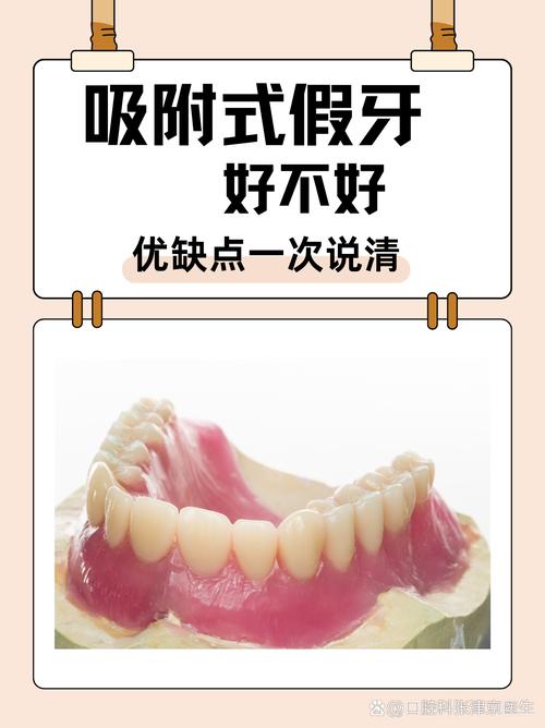 南京缺牙不种牙？活动假牙固定桥吸附性义齿哪个好