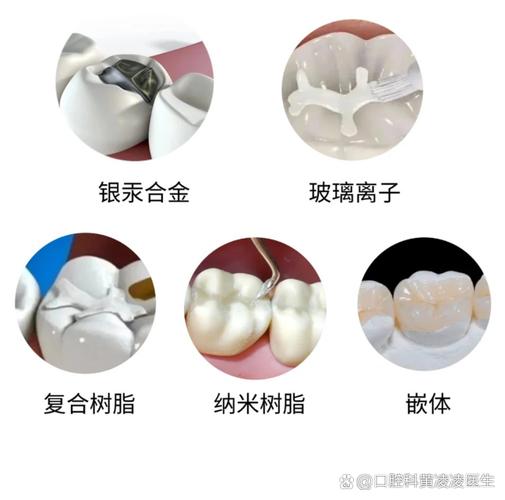 南京补牙用什么材料好?哪种补牙材料最靠谱?