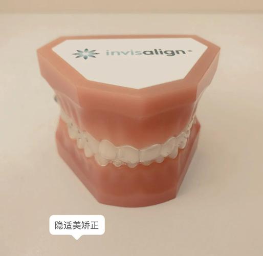 南京深圳牙缝过大矫正多少钱 明细与避坑指南