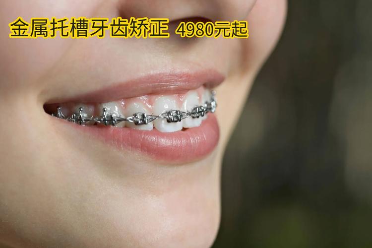 南京38岁还能做牙齿矫正吗 大龄正畸的真相与建议