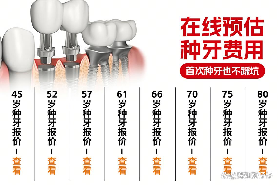 南京深圳罗湖种牙哪家靠谱 诺贝尔种植牙医院怎么选