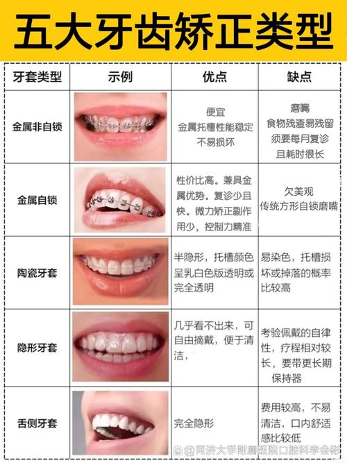 牙齿矫正能走医保吗_30岁能矫正牙齿吗_牙齿矫正能报销吗