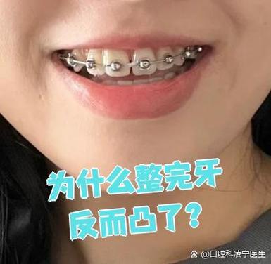 南京牙齿不齐别担心 纠正牙齿的较佳年龄看这里