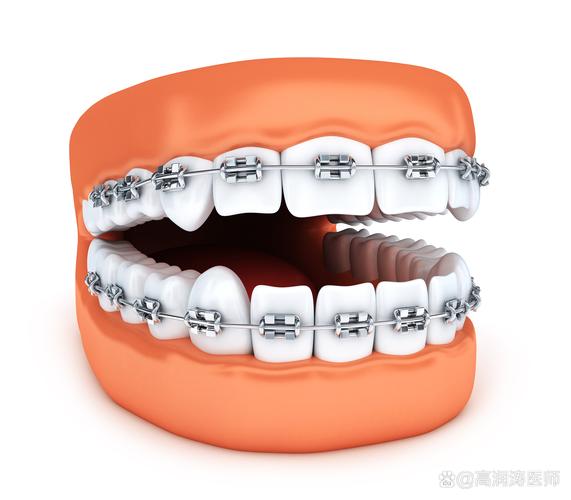 南京15岁矫正牙齿还来得及吗 能有效果吗