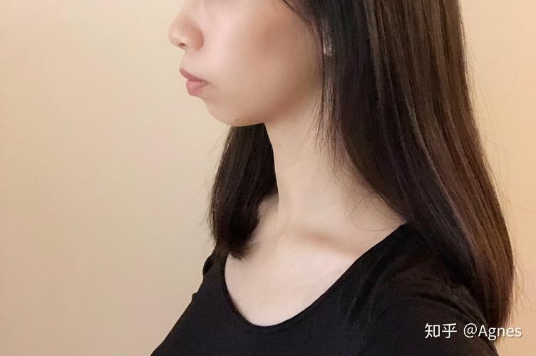 南京深圳龙岗隐适美矫正要多久？看完这篇就清楚了