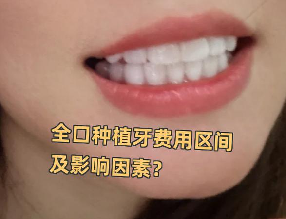 南京深圳罗湖骨量不足全口种牙大概多少钱