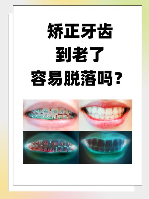 南京43岁矫正牙齿晚不晚 过来人告诉你答案