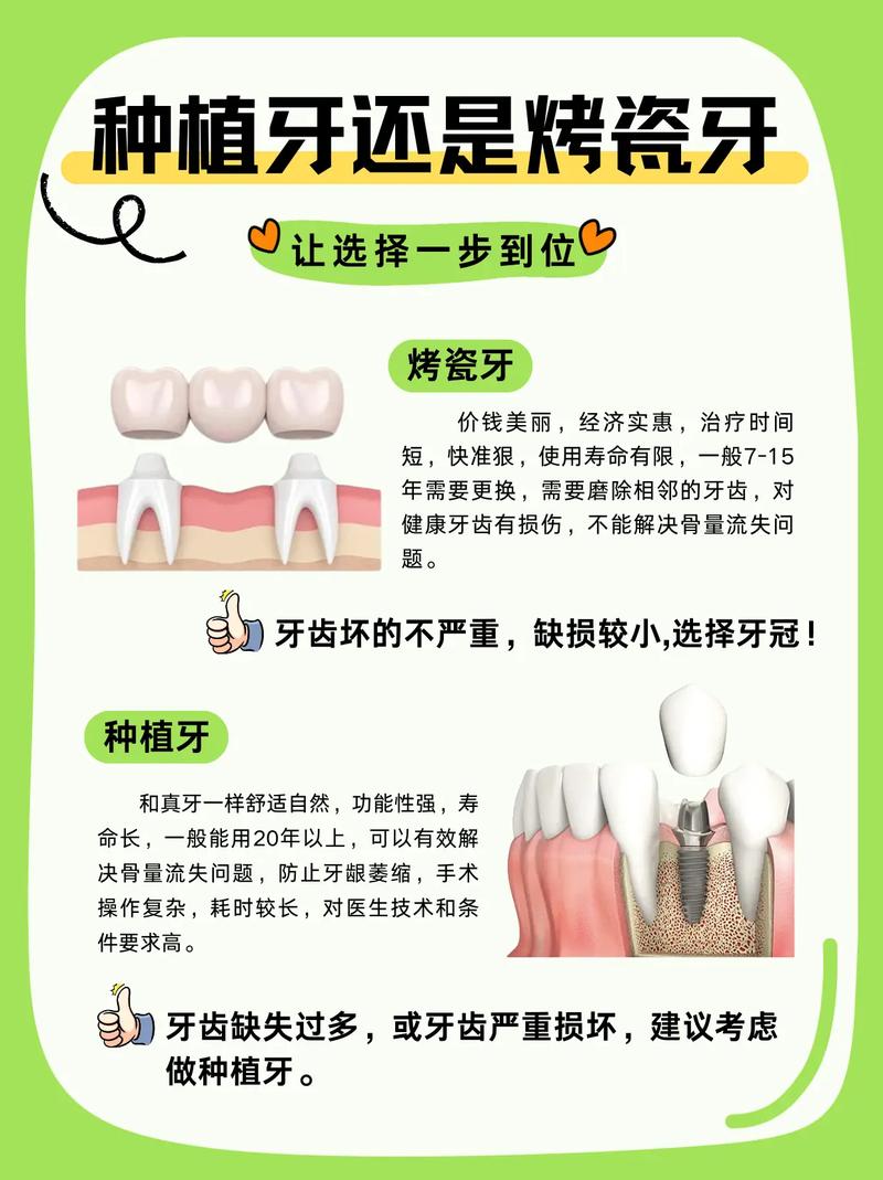南京烤瓷牙还是种植牙 牙医教你选对修复方式