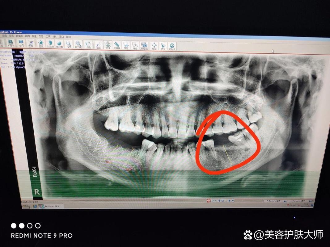 南京深圳皓圣种植牙医院靠谱吗 真实推荐指南