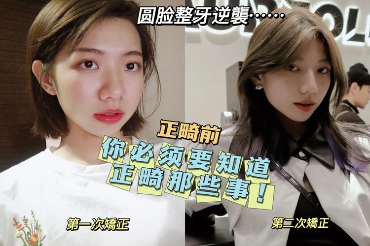 南京23岁整牙还来得及吗？过来人说实话