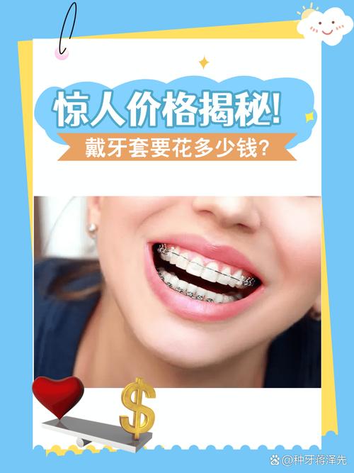 南京矫正牙齿透明牙套到底要花多少钱 看完心里有底