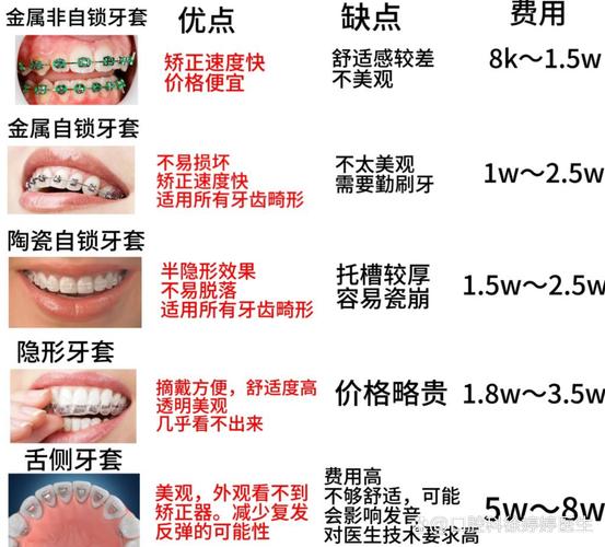 南京深圳福田青少年做钢丝牙套大概要花多少钱？