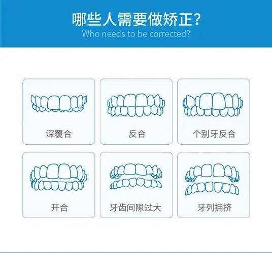 13岁男孩牙齿矫正需要多少钱_牙齿矫正大概要花_牙齿矫正男生