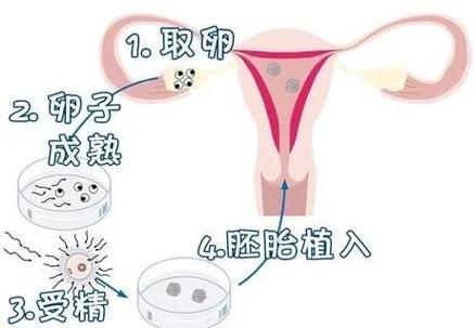 南京第三代试管婴儿准备多少预算？这笔账你得算明白