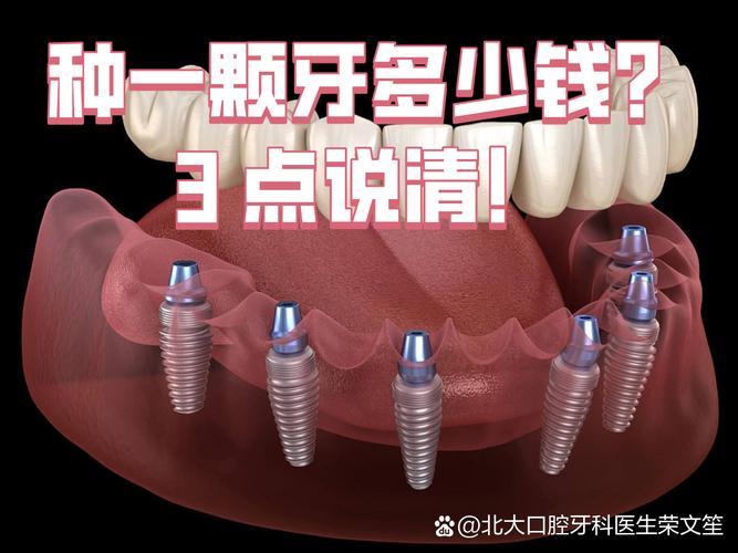南京沈阳种牙2026年单颗多少钱？3000到5200元能搞定吗
