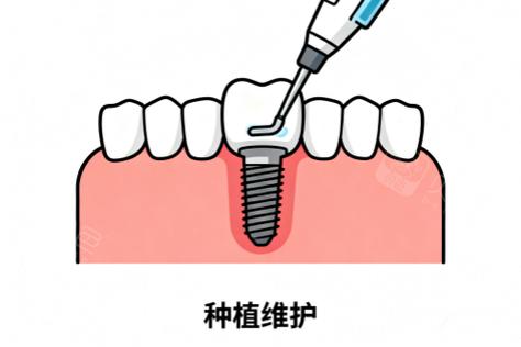 南京半口种植牙齿价位多少钱?2026年最新收费标准全解析
