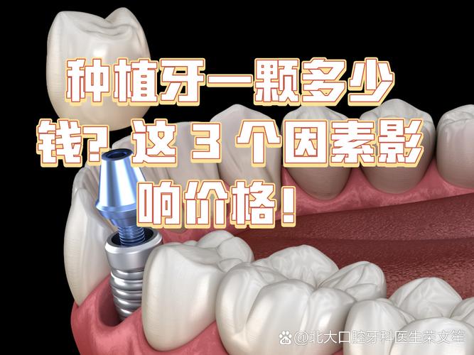 南京镶一颗种牙要多少钱 影响种植牙费用的关键因素梳理