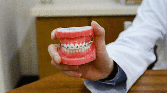 南京深圳蛇口隐形矫正到底多少钱？2026年真实费用大揭秘