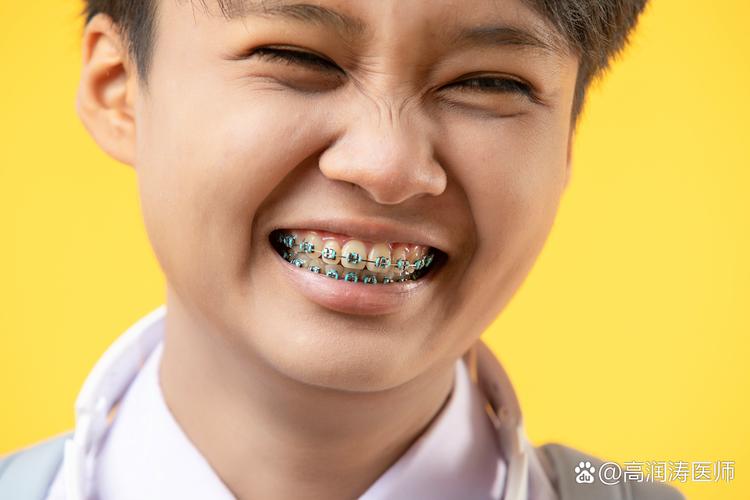 矫正牙齿更佳年龄_牙齿矫正一般多大年龄合适_牙齿矫正最好的年龄阶段是多少