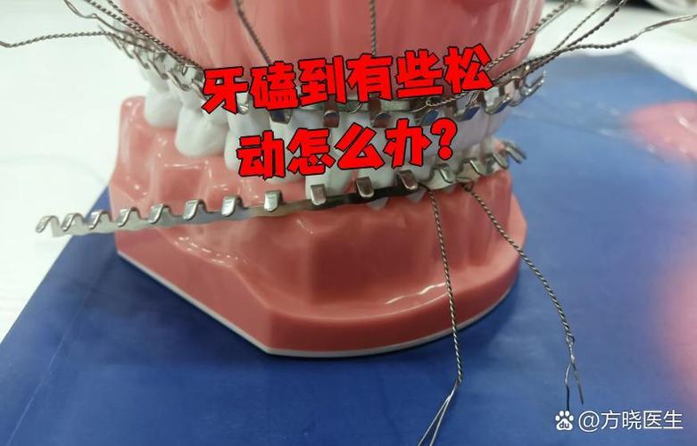 南京孩子牙齿磕碰松动了怎么办?多久能自己长好