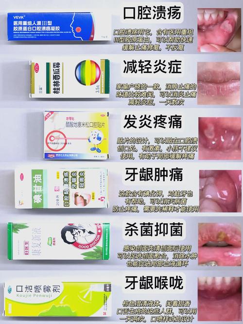 南京小孩口腔溃疡吃什么好的快?收下这份家庭偏方与饮食指南,轻松缓解娃的疼痛