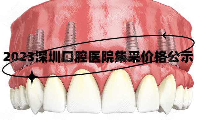 南京深圳种牙集采落地,到底能省多少钱?