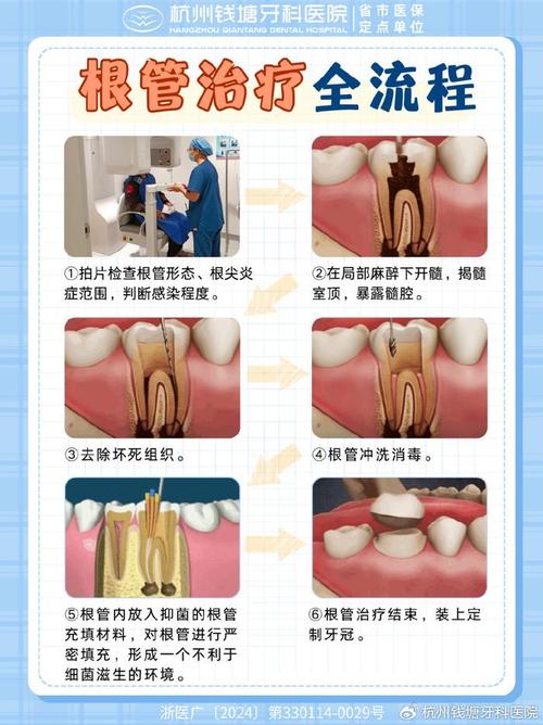 根治疗管补牙要多少钱_根管治疗补牙_根治疗管补牙要多久