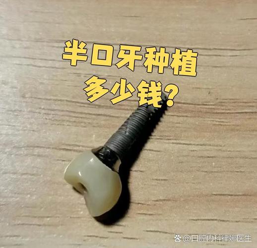 南京深圳宝安半口种牙多少钱 中老年价格详解