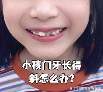 南京深圳孩子换牙门牙歪斜怎么办？专业干预指南与避坑建议