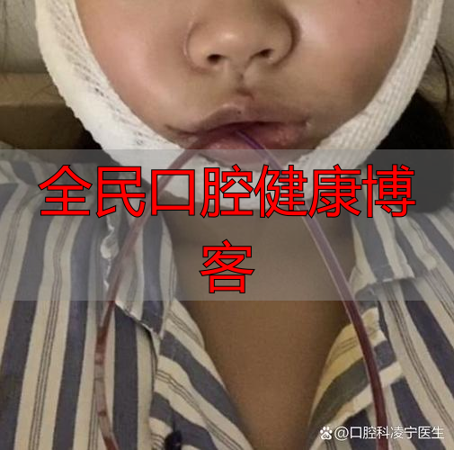 南京口腔颌面部受伤啥特点?不只影响呼吸进食,感染风险也很高