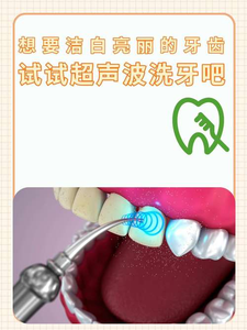 南京自己用超声波洗牙安全吗？洗牙是医疗行为，别自己瞎搞