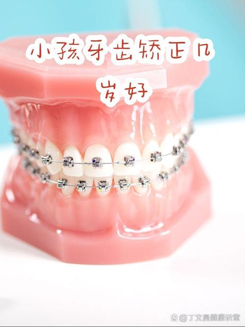 南京16岁牙齿矫正晚吗?医生:抓住黄金期,效果一样好