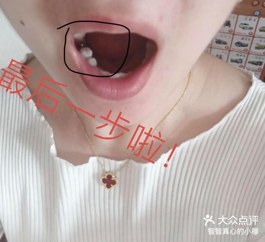 南京宝安新安种植牙哪家医院好?真实体验告诉你