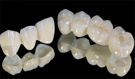 南京深圳全瓷牙哪家牙科好 真实经验分享
