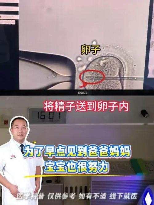 南京二代试管原理详解 卵胞浆内单精子注射如何助孕