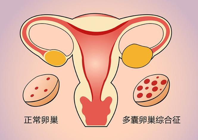 南京HIV治疗后到底能不能生孩子？感染者生育指南