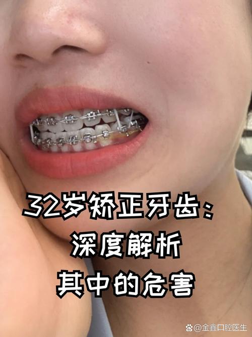 南京矫正牙齿有年龄限制吗?30岁、40岁做牙齿矫正还来得及吗