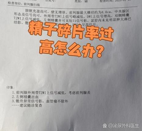南京精子DNA碎片率高怎么办 影响生育吗