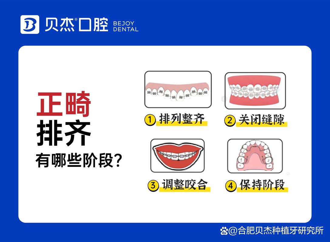 南京儿童牙齿排列不齐去哪家医院矫正效果最好？