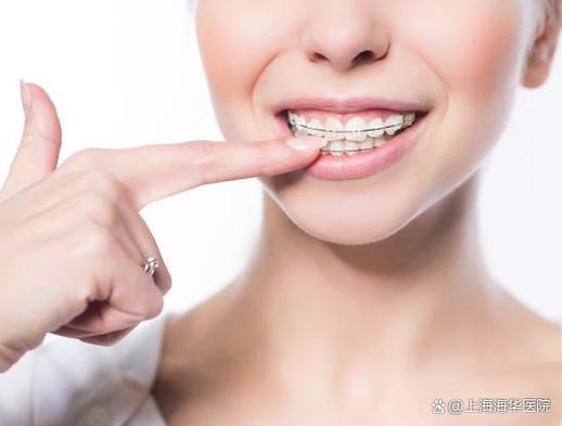 拜耳义齿_牙齿矫正拜耳价格是多少_拜耳牙齿矫正价格