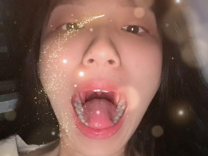 南京口腔检查第一视角真的有用吗?