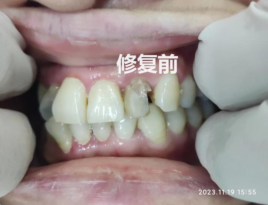 南京口腔诊疗服务怎么挑不踩坑?看牙前你最好先把这几条搞明白