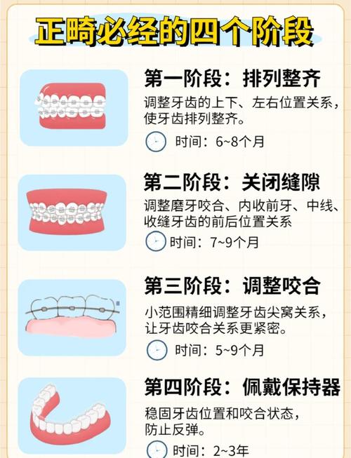 26岁牙齿矫正要几年_牙齿矫正年龄限制多少岁_牙齿矫正年龄多少合适