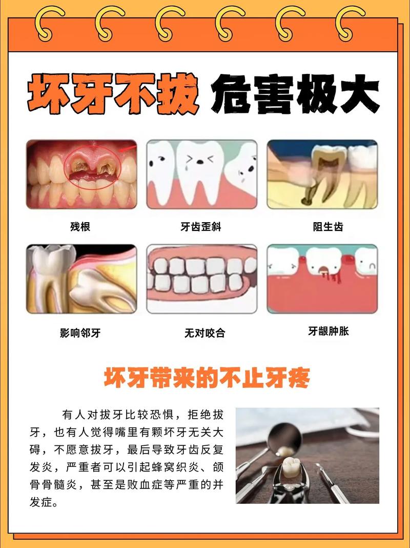 南京大牙拔掉后不种植 小心这些后果
