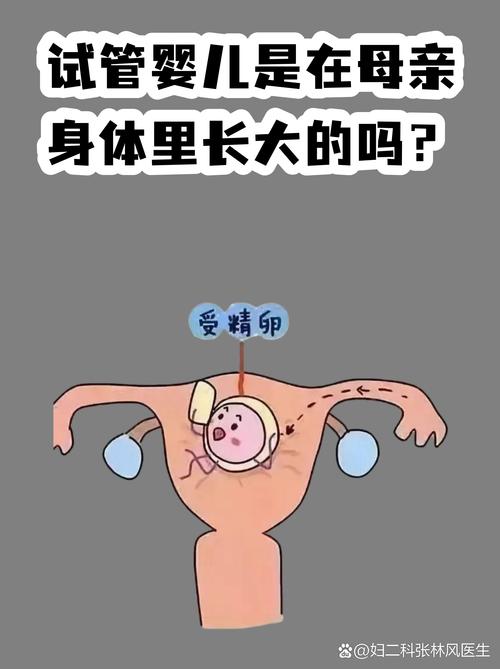 南京试管婴儿常见误区有哪些 专家一次说清