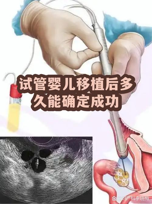 南京一代试管婴儿能成功吗 看完心里有底