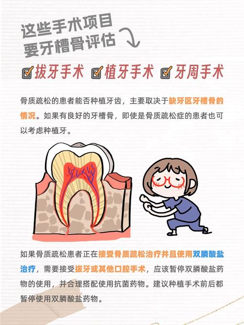 南京骨质疏松能种牙吗 掌握这几点放心种